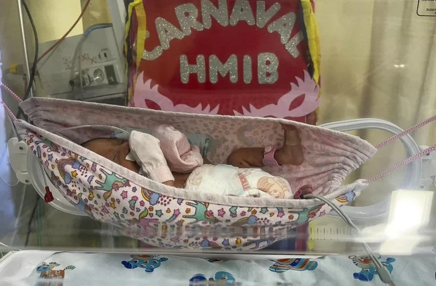 CARNAVAL INCLUSIVO: BEBÊS PREMATUROS DESFRUTAM DE CELEBRAÇÃO ESPECIAL NO HOSPITAL DE BARCARENA
